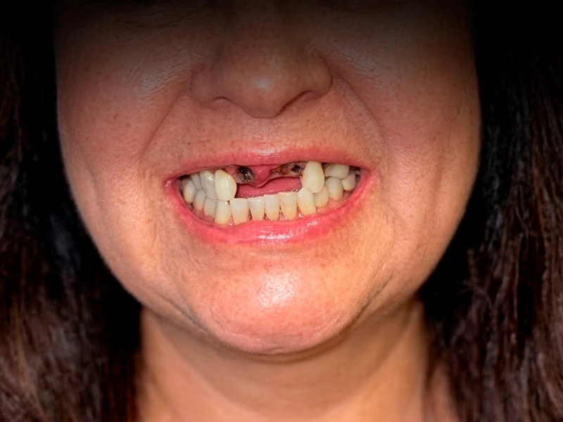 Patient 6 before
