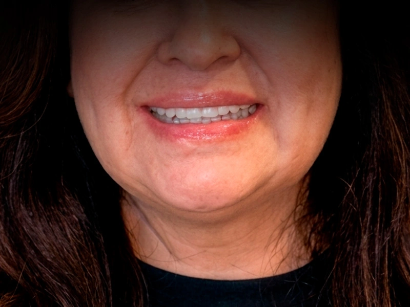 Patient 6 after